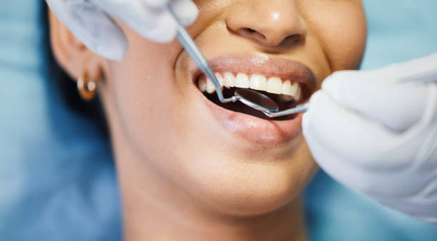 Best Teeth Whitening  in Thoreau, NM